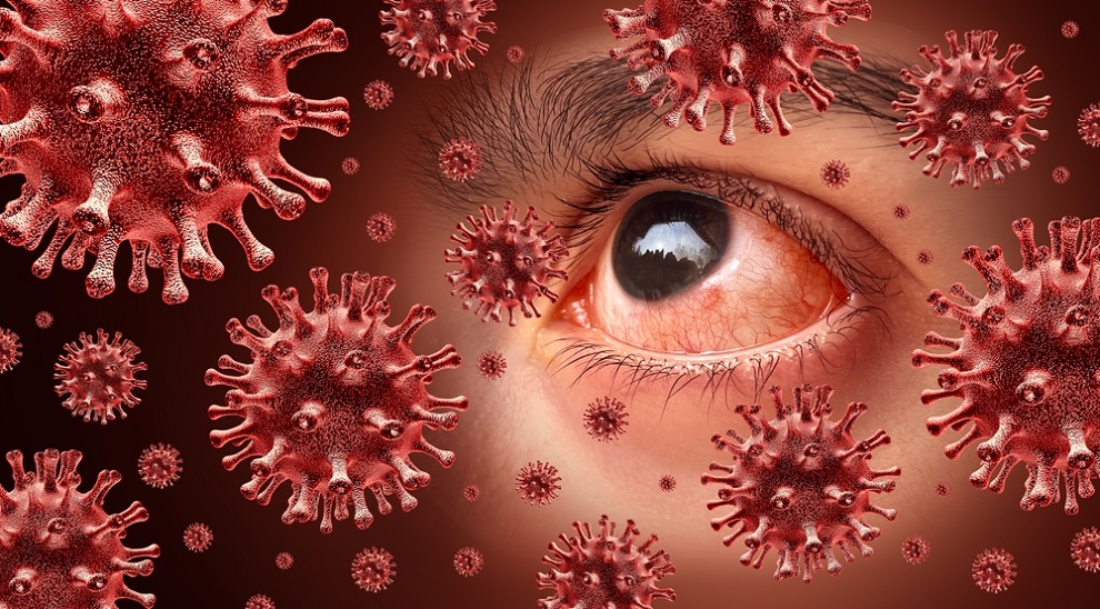 Các nguyên nhân phổ biến gây đau mắt đỏ (P1)